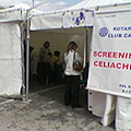 Celiachia, screening per la prevenzione